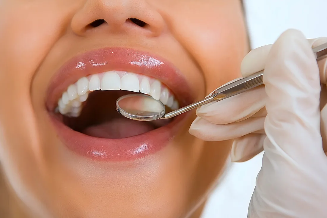 Patient receiving dental hygiene check-up