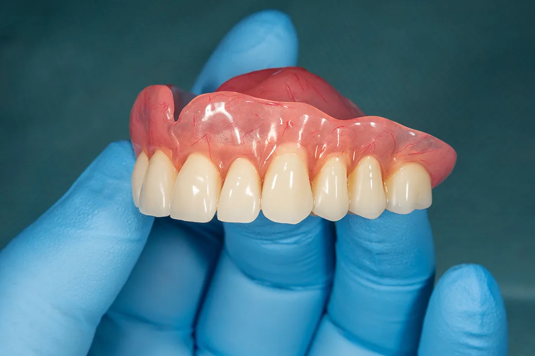 Dentist holding upper dentures