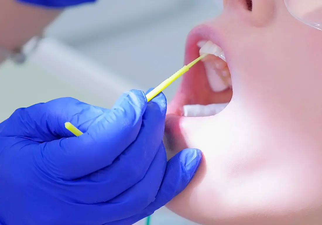 Leawood patient receiving fluoride treatments