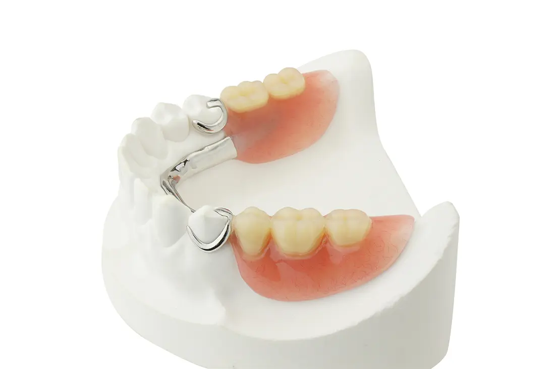 Model of partial dentures