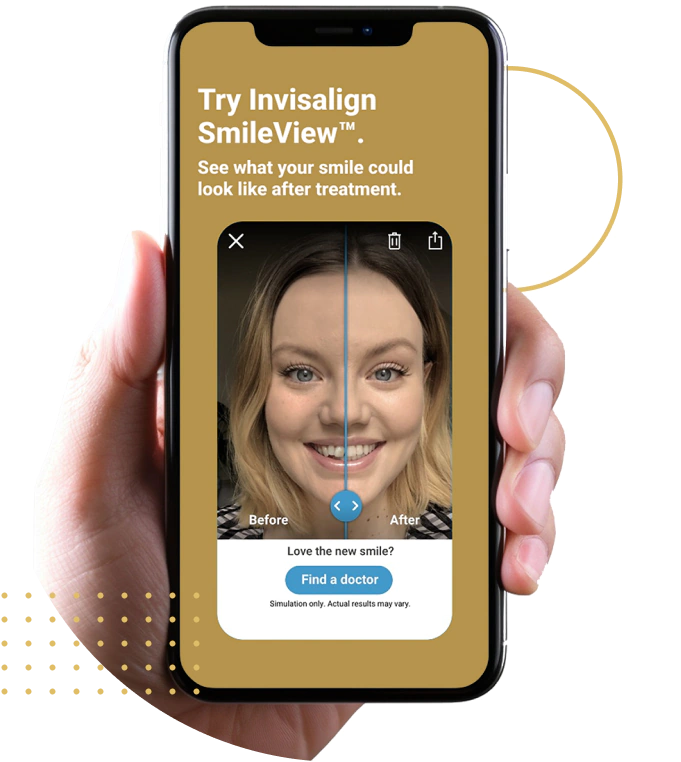 invisalign smile preview app