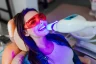 Can I Whiten My Teeth If I Have Cosmetic Work?